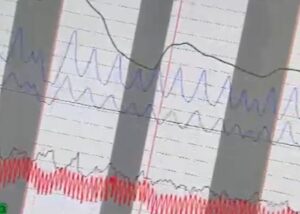 polygraph graph